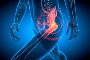 What Surgical Approach Is Right for Your Hip Replacement: Direct Anterior or Posterior Approach?